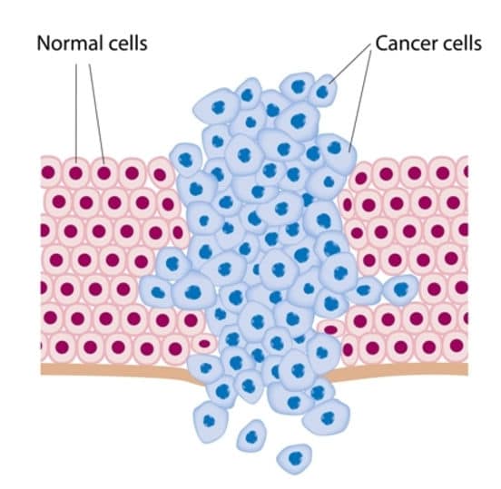 ما هو مرض السرطان