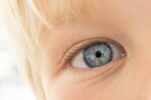 احمرار العين عند الأطفال